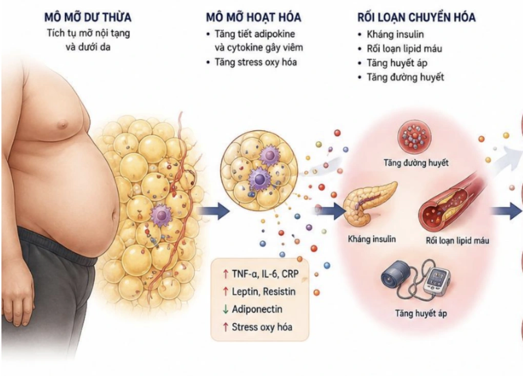 Béo phì là bệnh mạn tính: góc nhìn tim mạch và yêu cầu điều trị toàn diện