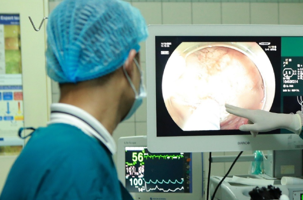 Tại sao người Việt hay bị chẩn đoán viêm dạ dày sai