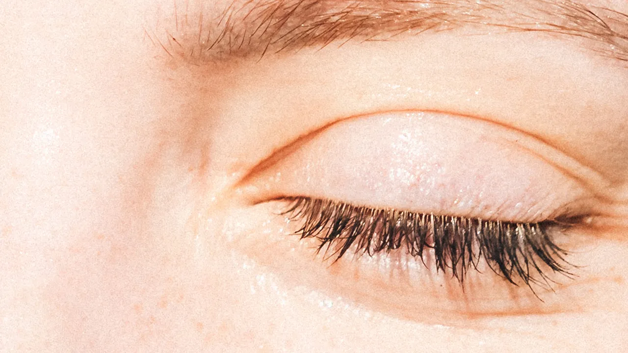 Chăm sóc da sau laser, microneedling và XERF: đừng xem nhẹ peptides và postbiotics