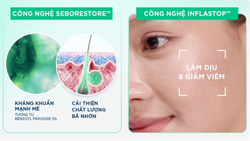 Chất lượng bã nhờn và cuộc chiến da dầu mụn