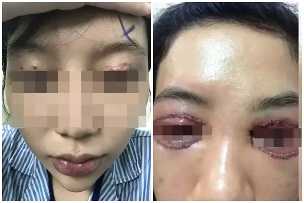 Những cơ sở thẩm mỹ bị xử phạt: hồi chuông cảnh báo khách hàng