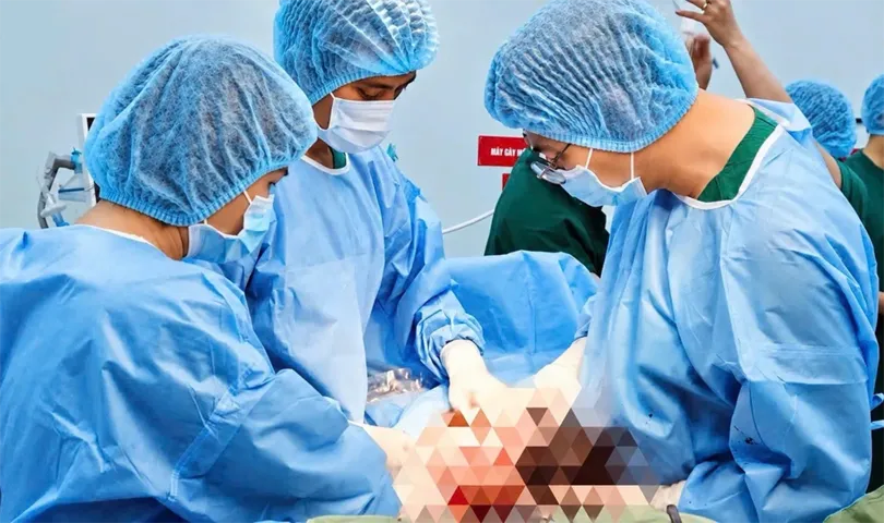 Phẫu thuật bóc tách khối u buồng trứng khổng lồ: kỹ thuật nâng cao và những ranh giới sinh tử