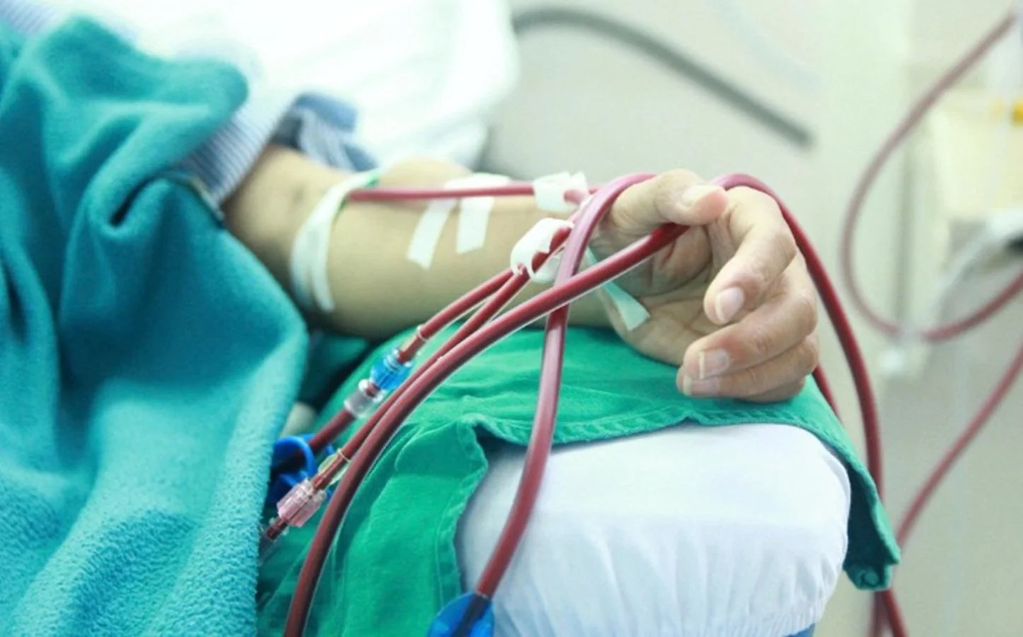 5 dấu hiệu cảnh báo sớm bệnh thận ở người trẻ bạn không nên bỏ qua