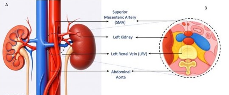 Nước tiểu nổi bọt kéo dài: Đừng đợi đến suy thận giai đoạn 3 mới giật mình