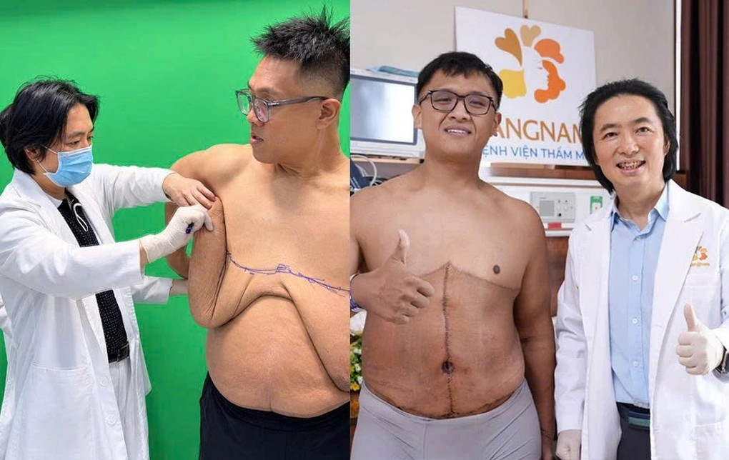 Từ 105kg đến thành công: 3 hành trình giảm cân ngoạn mục và lời cảnh tỉnh