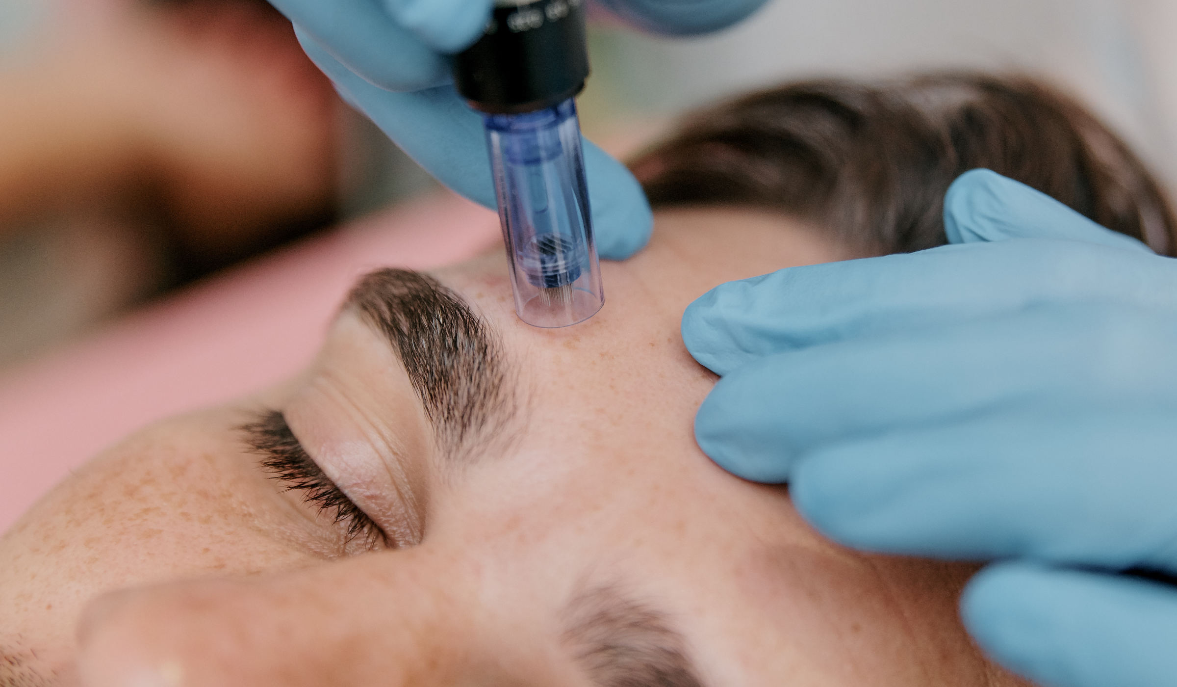 Chăm sóc da sau laser, microneedling và XERF: đừng xem nhẹ peptides và postbiotics