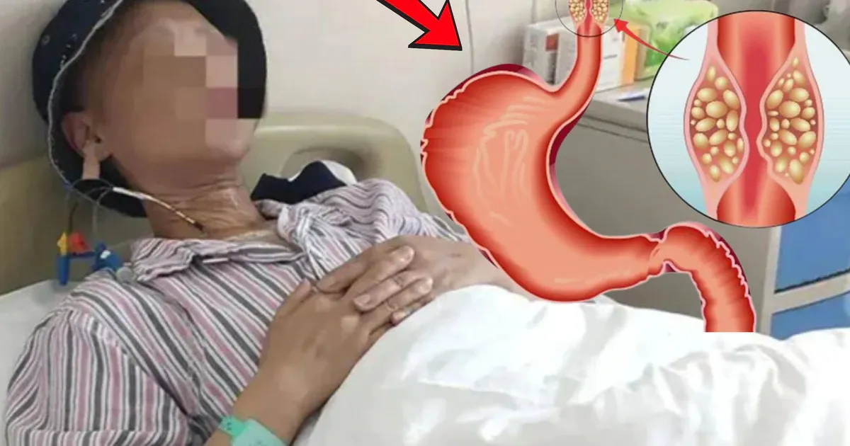 Phát hiện ung thư phổi sớm: CT liều thấp đang cứu sống ai?