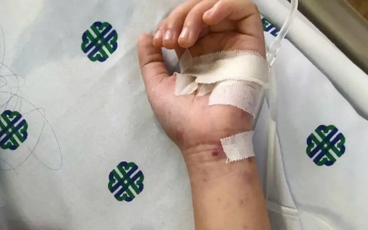 Sau ca tử vong do não mô cầu: Phòng ngừa quan trọng hơn điều trị