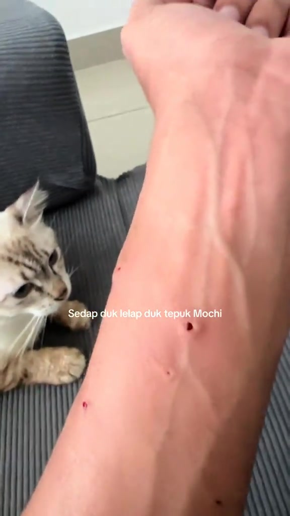 Lengan manusia dengan beberapa kesan gigitan kecil di sebelah kucing putih kelabu di sofa