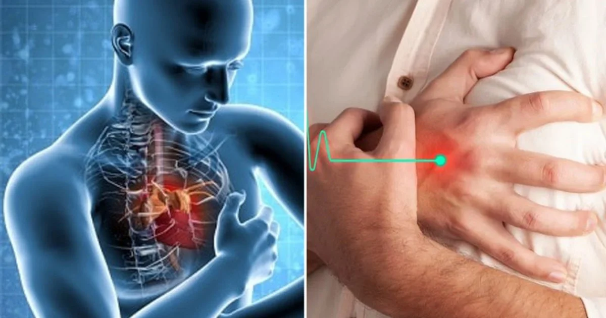 Những dấu hiệu âm thầm của nhồi máu cơ tim: Đừng chỉ chờ đau ngực