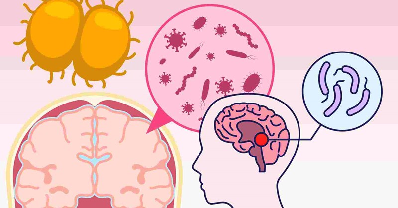 Não mô cầu có thể diễn tiến trong vài giờ: Nhận biết dấu hiệu cảnh báo sớm
