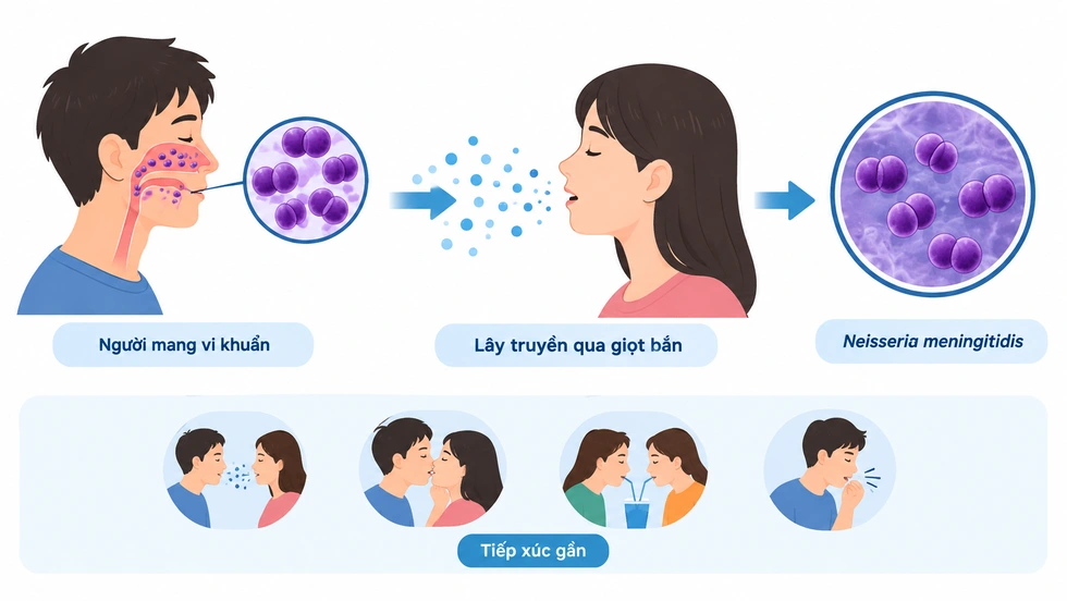 Bệnh não mô cầu có thể trở nặng trong vài giờ: Nhận biết dấu hiệu và cách phòng ngừa