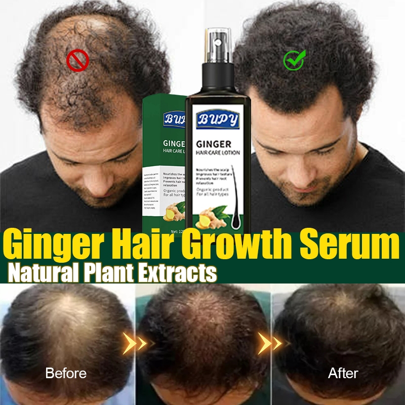 Lowest Price Ever Ginger Hair Growth Spr