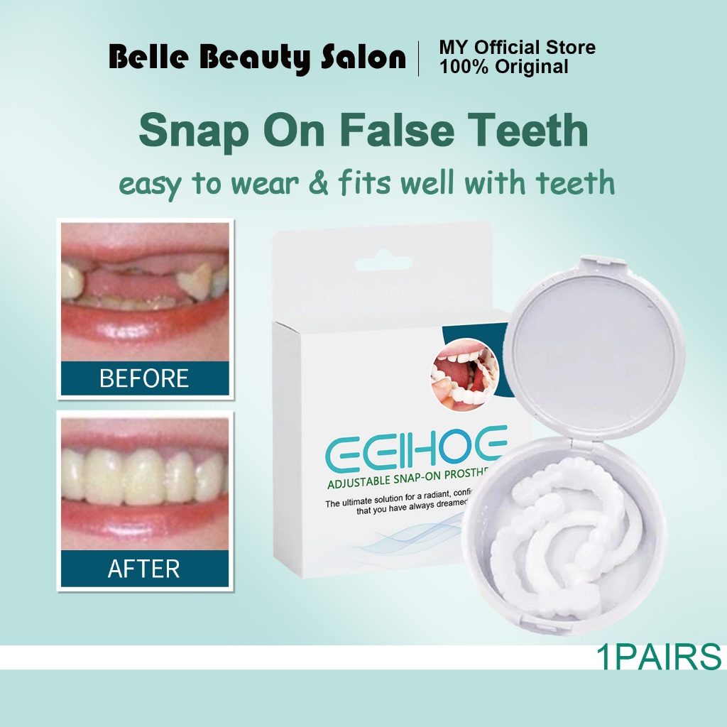 EELHOE Gigi Palsu Boleh Laras Snap On Veneer Kit - Gigi Pals
