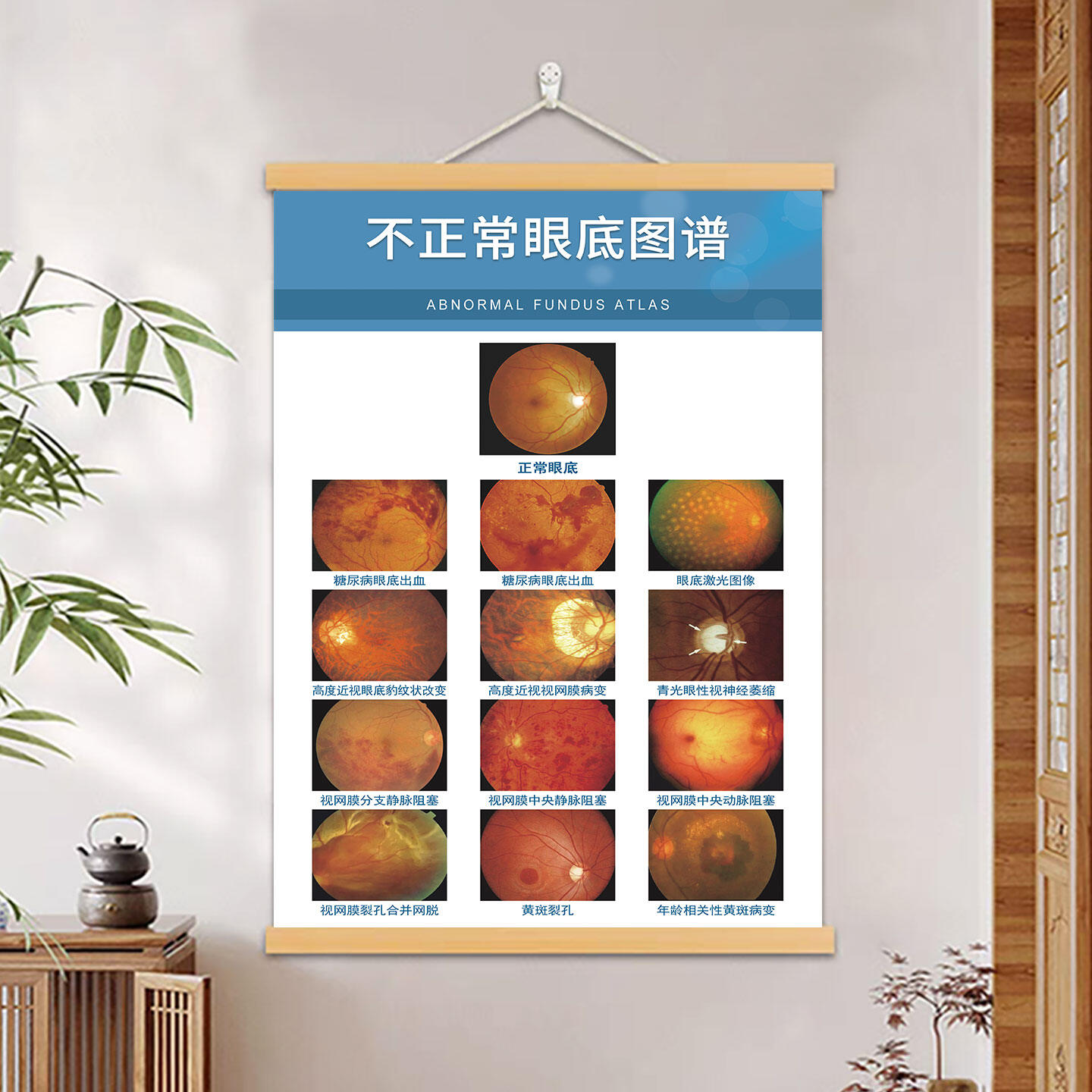 35% Drop: Kids Eye Chart Art