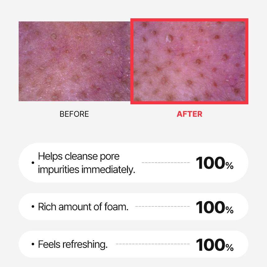 25% Drop: WJ A.Cneed Foam Cleanser