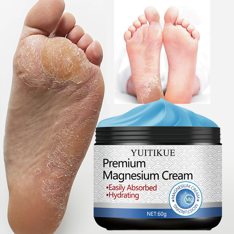 20.7% drop on YUITIKUE cream