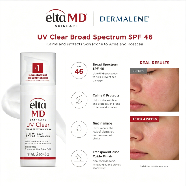 Hot Sale Promo EltaMD UV Clear Face Sunscreen SPF 46, oil-free sunscreen with zinc oxide, recommended by dermatologists. | Lazada Malaysia
