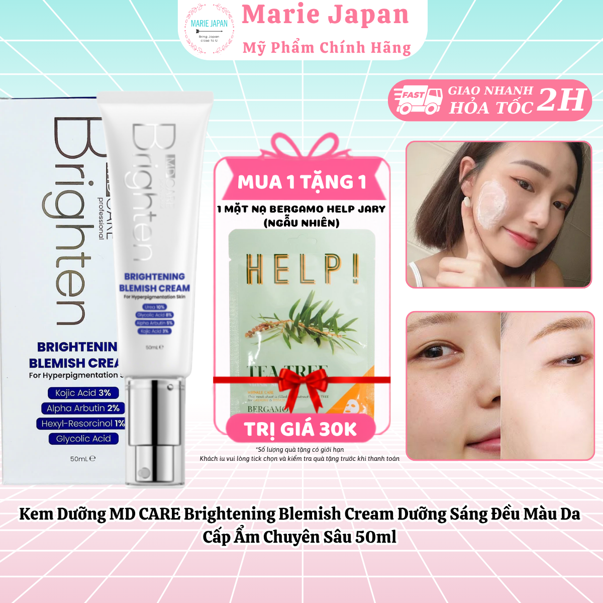 [MUA 1 TẶNG 1] Kem Dưỡng MD CARE Brightening Blemish Cream Dưỡng Sáng Đều Màu Da Cấp Ẩm Chuyên Sâu 50ml-TẶNG 1 MẶT NẠ BERGAMO HELP JARY